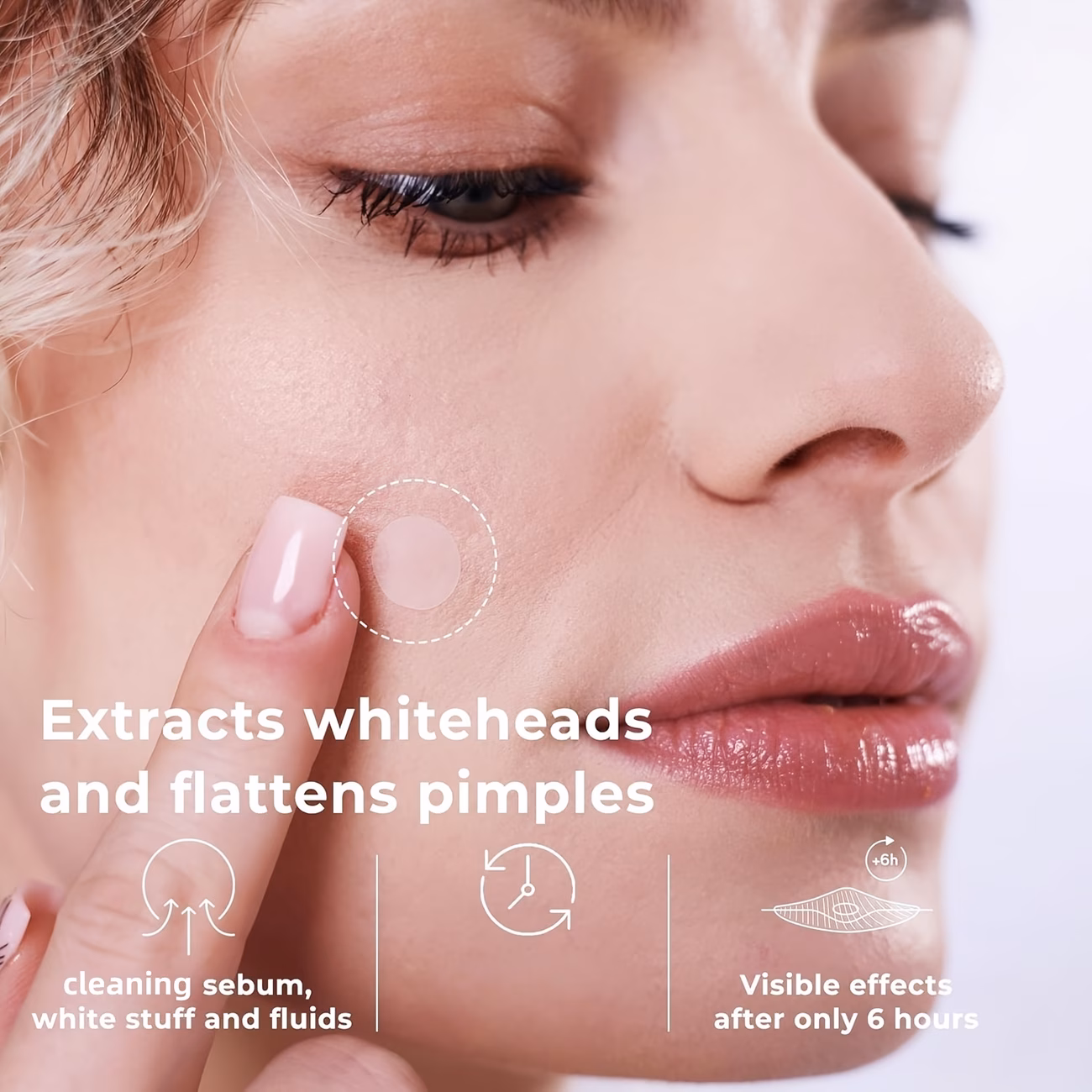 Pimple Patch for Covering Zits & Blemishes (Spot Stickers for Face & Skin) - Image 2